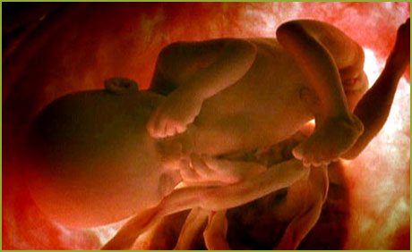 Un aplauso a... el concurso "El embrión humano, el más pequeño de los hermanos" 1