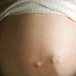 Los abortos por anomalías del feto crecen en España 1