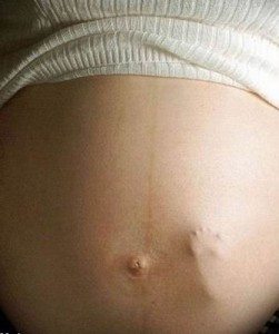 Lo que opinan los ginecólogos estadounidenses sobre cuándo empieza la vida humana 2