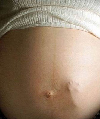 La niña chilena violada y embarazada apuesta por la vida: "va a ser como una muñeca que voy a tener en mis brazos" 1